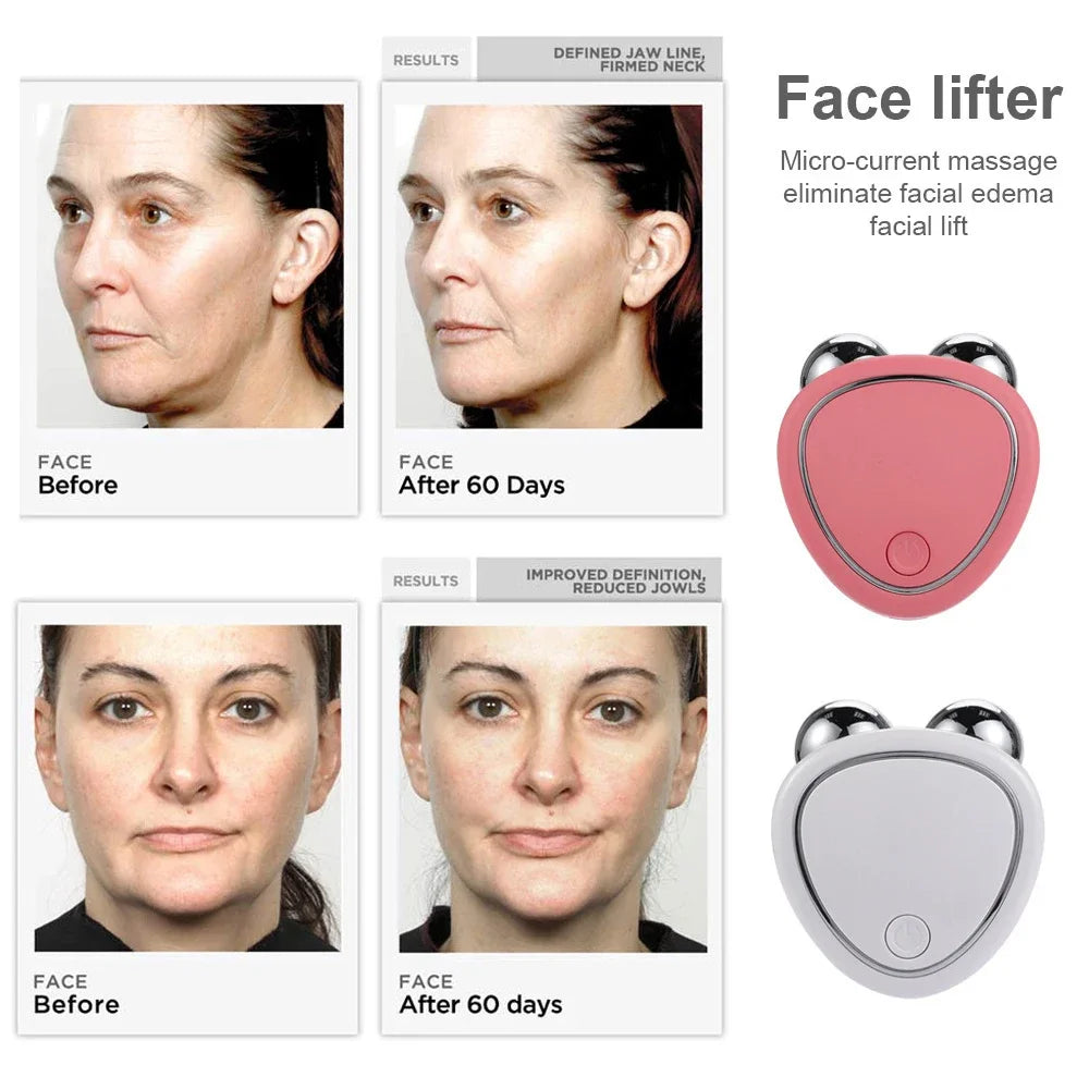 Microcurrent Roller Skin Tightening Rejuvenation Beauty