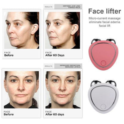 Microcurrent Roller Skin Tightening Rejuvenation Beauty